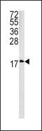 Caveolin 3 antibody, PA5-13443, Invitrogen Antibodies, Western Blot image 