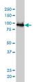 Ubiquitin Protein Ligase E3A antibody, LS-C133508, Lifespan Biosciences, Western Blot image 