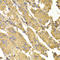 Protein Phosphatase 2 Catalytic Subunit Alpha antibody, LS-C334893, Lifespan Biosciences, Immunohistochemistry frozen image 