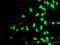 RNA Polymerase I And III Subunit C antibody, H00009533-M01, Novus Biologicals, Immunocytochemistry image 