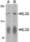 Interleukin 32 antibody, LS-B576, Lifespan Biosciences, Western Blot image 