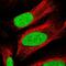 TATA-Box Binding Protein Associated Factor 13 antibody, NBP1-92474, Novus Biologicals, Immunocytochemistry image 
