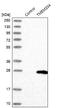 Transmembrane Protein 204 antibody, NBP1-88444, Novus Biologicals, Western Blot image 