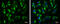 ATP Synthase F1 Subunit Alpha antibody, GTX101741, GeneTex, Immunofluorescence image 