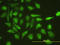Ubiquitin Conjugating Enzyme E2 G1 antibody, LS-C198396, Lifespan Biosciences, Immunofluorescence image 