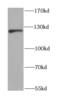 Nuclear Factor Kappa B Subunit 1 antibody, FNab05703, FineTest, Western Blot image 