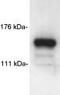 SIN3 Transcription Regulator Family Member A antibody, ab3479, Abcam, Western Blot image 