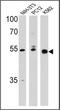 Peroxisome Proliferator Activated Receptor Delta antibody, NBP2-22468, Novus Biologicals, Western Blot image 