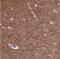 alpha-Tubulin antibody, NBP2-54687, Novus Biologicals, Immunohistochemistry paraffin image 