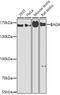 BCL2 Associated Athanogene 6 antibody, GTX55530, GeneTex, Western Blot image 