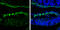 Tubulin Beta 3 Class III antibody, GTX130245, GeneTex, Immunohistochemistry frozen image 