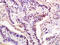 THO Complex 2 antibody, GTX51521, GeneTex, Immunohistochemistry paraffin image 