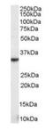 Killer Cell Lectin Like Receptor K1 antibody, orb19046, Biorbyt, Western Blot image 