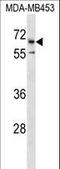 Cation channel sperm-associated protein 2 antibody, LS-C159272, Lifespan Biosciences, Western Blot image 