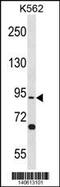 Testis Specific 10 antibody, 60-621, ProSci, Western Blot image 