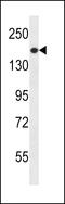 Phosphatidylinositol-3,4,5-Trisphosphate Dependent Rac Exchange Factor 1 antibody, 56-514, ProSci, Western Blot image 