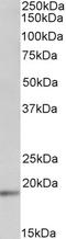 Ubiquitin Conjugating Enzyme E2 C antibody, STJ71979, St John