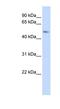 Transmembrane Protein 266 antibody, NBP1-79519, Novus Biologicals, Western Blot image 