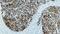 Folate Hydrolase 1 antibody, GTX01882, GeneTex, Immunohistochemistry paraffin image 