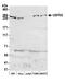 Ubiquitin Specific Peptidase 9 X-Linked antibody, A301-350A, Bethyl Labs, Western Blot image 