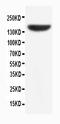 Apoptotic Peptidase Activating Factor 1 antibody, PA1249, Boster Biological Technology, Western Blot image 