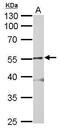 Glycine Receptor Alpha 2 antibody, PA5-21673, Invitrogen Antibodies, Western Blot image 