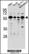 Forkhead Box C2 antibody, 55-926, ProSci, Western Blot image 