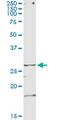 Testis Specific Serine Kinase 3 antibody, MA5-24576, Invitrogen Antibodies, Immunoprecipitation image 