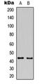 Growth Associated Protein 43 antibody, abx121401, Abbexa, Western Blot image 