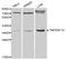 TNF Receptor Superfamily Member 1A antibody, MBS125977, MyBioSource, Western Blot image 