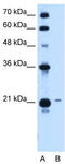 T-complex protein 10A homolog 2 antibody, TA338953, Origene, Western Blot image 