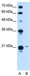 T-Complex 10 Like antibody, TA338953, Origene, Western Blot image 