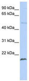 Zinc Finger Protein 79 antibody, TA339146, Origene, Western Blot image 