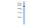 Cyclin Dependent Kinase Like 2 antibody, GTX44835, GeneTex, Western Blot image 