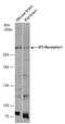 Inositol 1,4,5-Trisphosphate Receptor Type 1 antibody, GTX133104, GeneTex, Western Blot image 