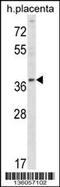 Ubiquitin Conjugating Enzyme E2 Q2 antibody, 58-659, ProSci, Western Blot image 