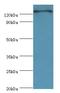 Ret Proto-Oncogene antibody, LS-C376494, Lifespan Biosciences, Western Blot image 