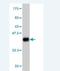 NIPBL Cohesin Loading Factor antibody, H00025836-M01, Novus Biologicals, Western Blot image 