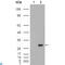 Carbonic Anhydrase 1 antibody, LS-C812407, Lifespan Biosciences, Western Blot image 