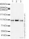 Lysine Demethylase 1A antibody, ab17721, Abcam, Western Blot image 