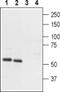 Parathyroid Hormone 2 Receptor antibody, PA5-77690, Invitrogen Antibodies, Western Blot image 
