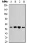 Interferon Gamma Receptor 1 antibody, orb339134, Biorbyt, Western Blot image 