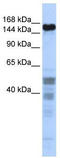 Zinc Finger Protein 335 antibody, TA345356, Origene, Western Blot image 