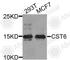 Cystatin E/M antibody, A8115, ABclonal Technology, Western Blot image 