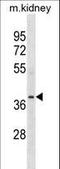 POC1 Centriolar Protein A antibody, LS-C158692, Lifespan Biosciences, Western Blot image 