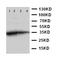 Eukaryotic Translation Initiation Factor 2 Alpha Kinase 4 antibody, LS-C313155, Lifespan Biosciences, Western Blot image 