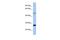 MIS12 Kinetochore Complex Component antibody, PA5-44882, Invitrogen Antibodies, Western Blot image 