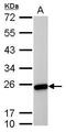 Transgelin antibody, MA5-17276, Invitrogen Antibodies, Western Blot image 