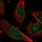 Zinc Finger Protein 124 antibody, NBP1-81634, Novus Biologicals, Immunofluorescence image 