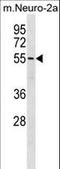 Bromodomain Containing 9 antibody, LS-C159182, Lifespan Biosciences, Western Blot image 